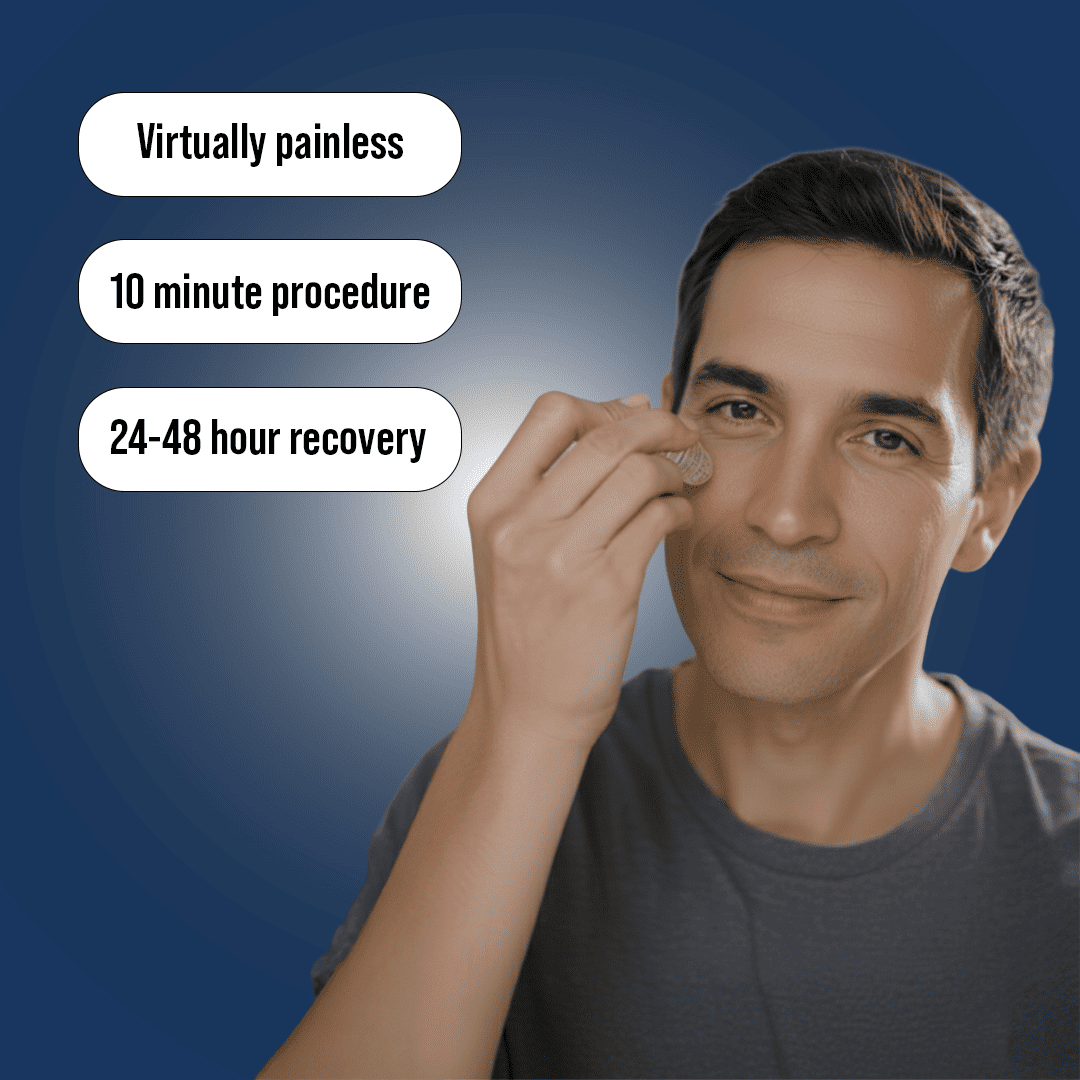 Microneedling Scar recovery