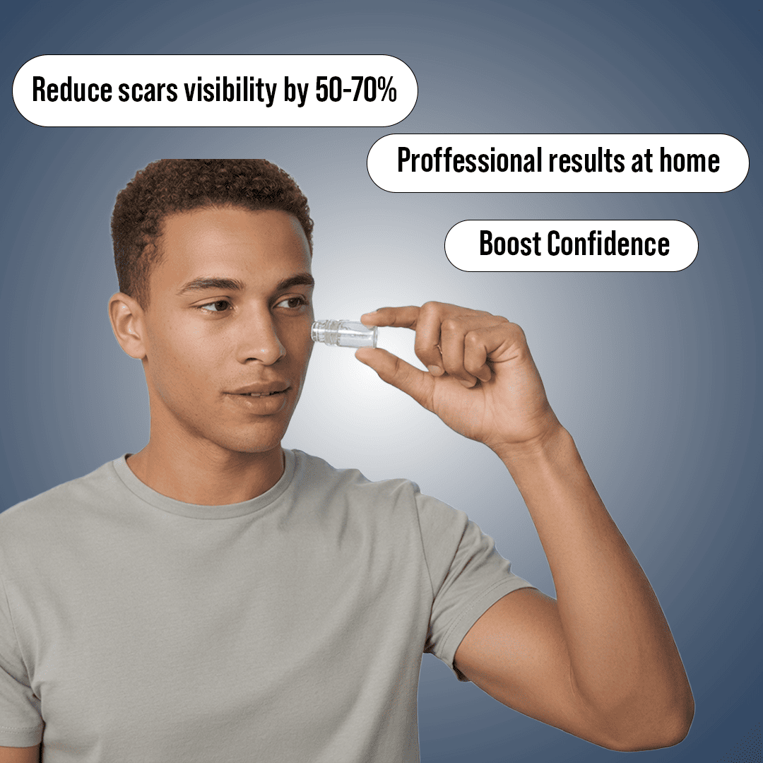 Microneedling Scar recovery