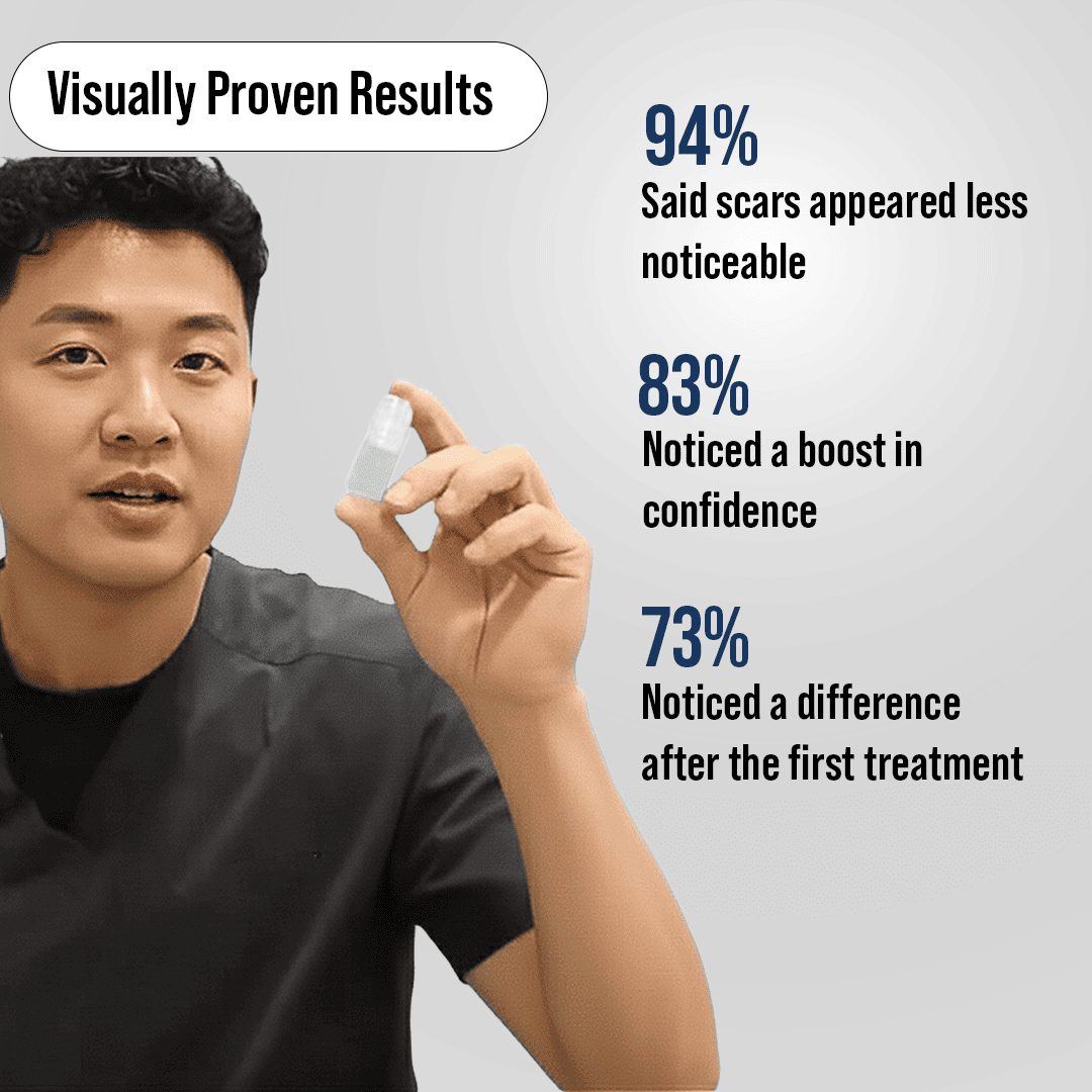 Microneedling Scar recovery